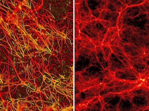 brain tissue, on the left; network of galaxies, on the right; awe interspersed